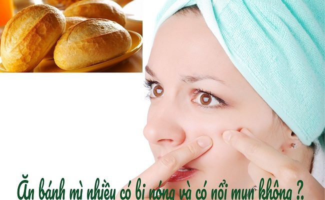 Ăn bánh mì nhiều có bị nóng và có nổi mụn không ?
